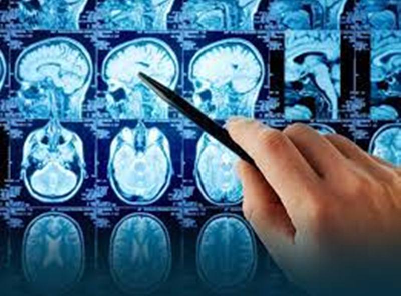 Unique brain surgery at Fortis