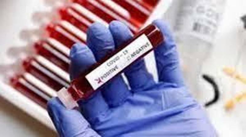 COVID-19: 26 more cases in Kangra