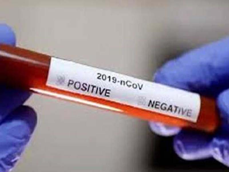 Telangana logs 157 new COVID-19 cases,one fatality until Sunday night