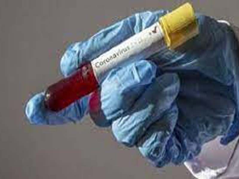 COVID: Aurangabad registers 1,207 cases, 34 deaths