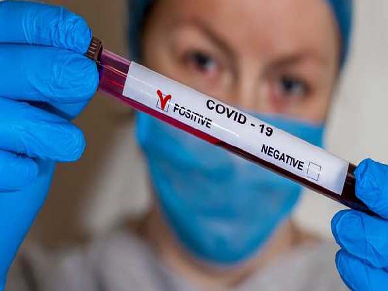COVID-19: 156 CAPF personnel test positive in 24 hrs, total surges to 577