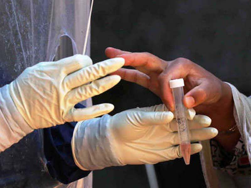 India records 72,330 nCoV cases, 459 deaths