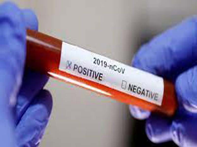 UP to launch mega covid-19 testing campaign in rural areas from May 4