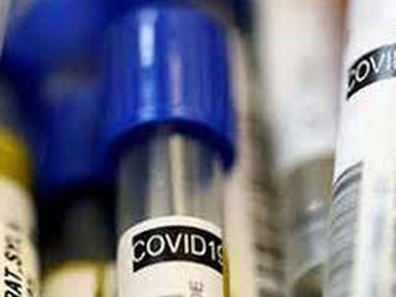 UP records 18,125 COVID-19 cases, 329 deaths