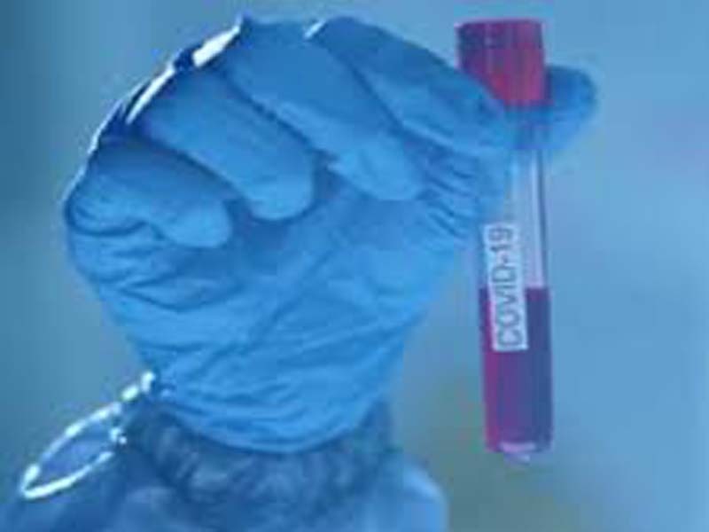 Aurangabad reports 944 positive COVID cases and 27 deaths
