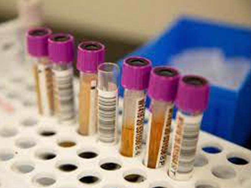 Karnataka reports 10959 fresh cases and 192 deaths