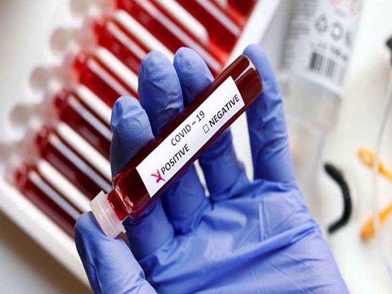 J&K reports 585 new COVID + ve cases, 14 deaths