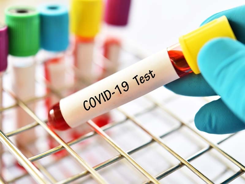 Covid-19: 114 new cases detected in Nashik