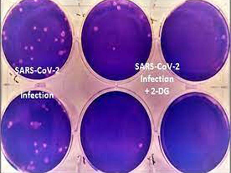 2DG effectively inhibits SARS-CoV-2 growth in patients: Sateesh Reddy