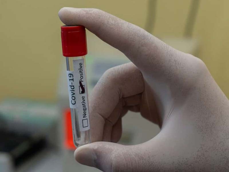 COVID-19: AP reports 57 deaths, 6,341 new cases