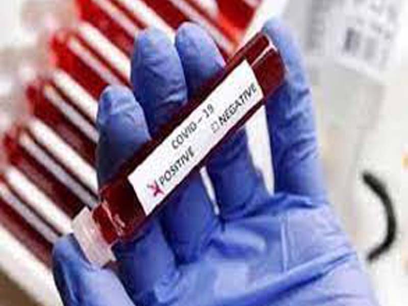 Marathwada region registers 1,394 Covid-19 cases, 72 fatalities