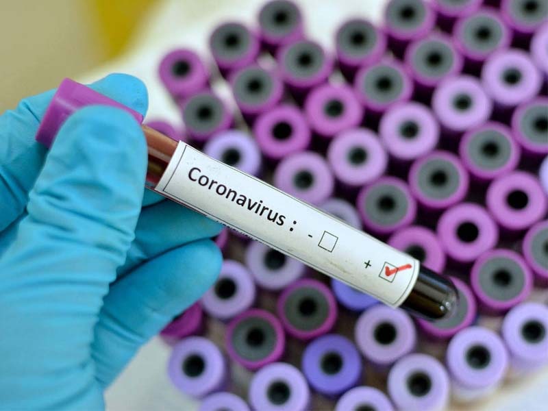Telangana reports 729 new COVID-19 cases, 6 fatalities