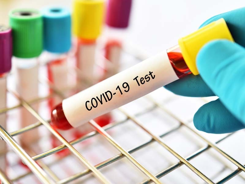 HP registers 13 Covid-19 cases, 151 recoveries in the past 24 hrs