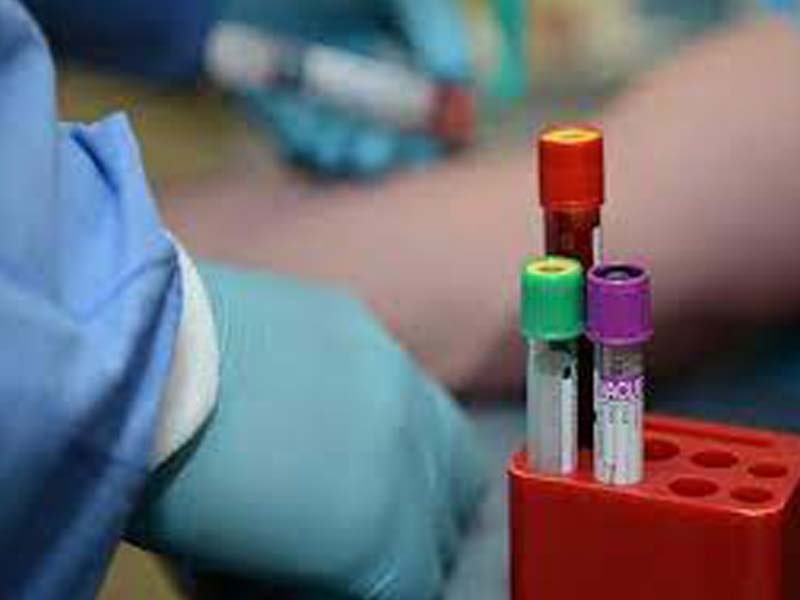 Iran reports 36,758 new COVID-19 cases, 4,833,135 in total