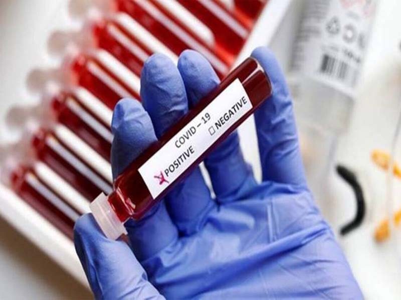 Telangana registers 245 fresh COVID-19 cases, one fatality