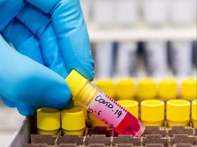 COVID-19: Goa reports 74 new cases, 4 deaths