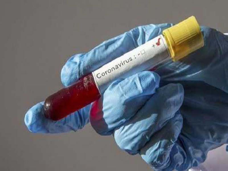 Fresh Covid-19 cases dip in UT