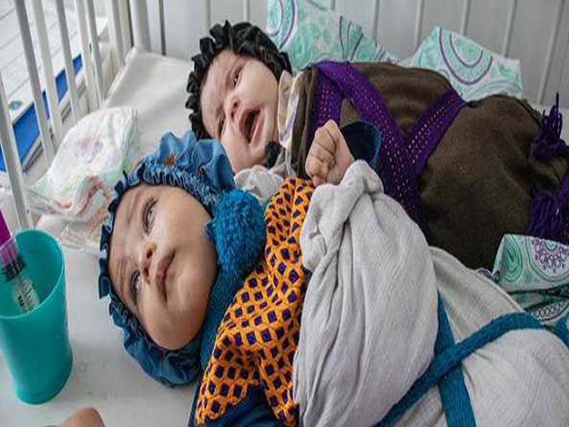 UNICEF official warns of worse situation in Afghanistan
