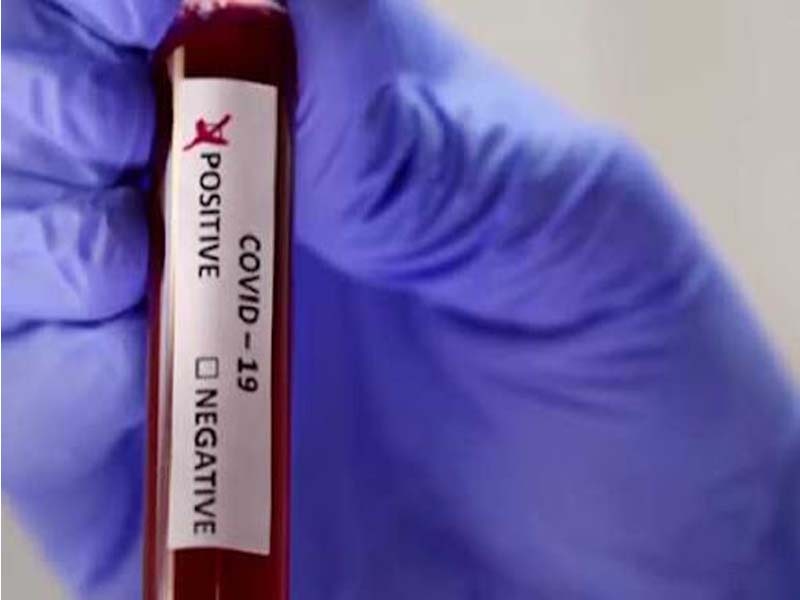 COVID19: Sikkim reports 4 new COVID-19 cases