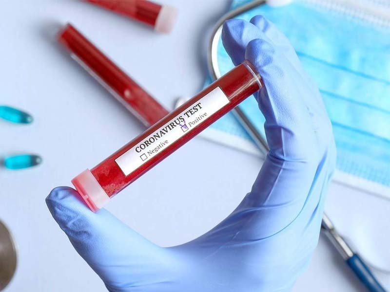 128 new Corona cases in Thane dist : Authorities