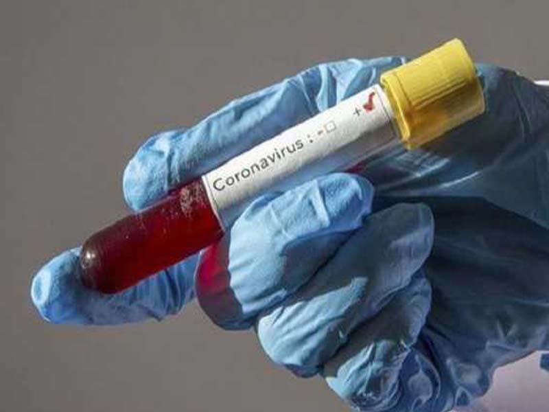 Thane reports 113 new Covid cases