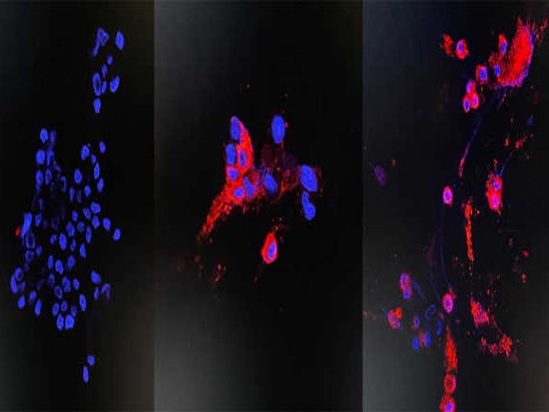 Scientists at Hong Kong University first in Asia to isolate Omicron coronavirus variant