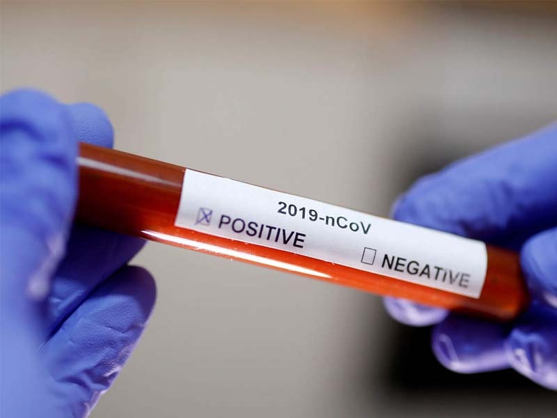 Nashik:4,65,566 patients cured of Corona