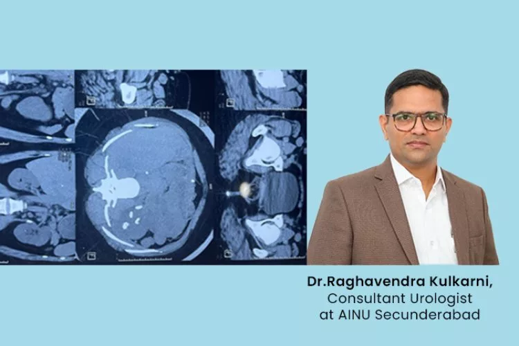 A kidney crisis results from antibiotic decisions made by Google.
