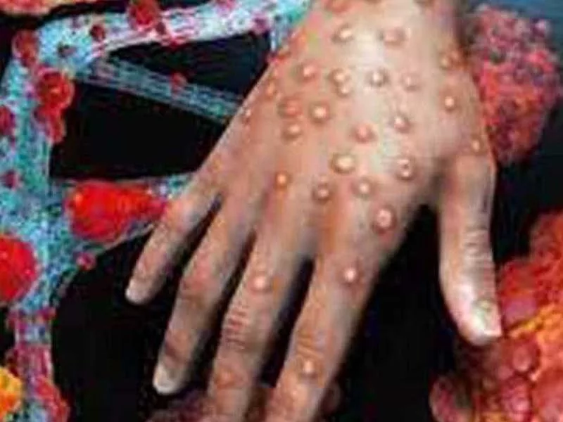 There are six monkey pox deaths in southern Vietnam.