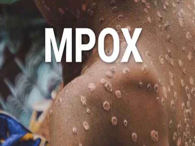 The Health Ministry reports 30 instances of mpox in India.